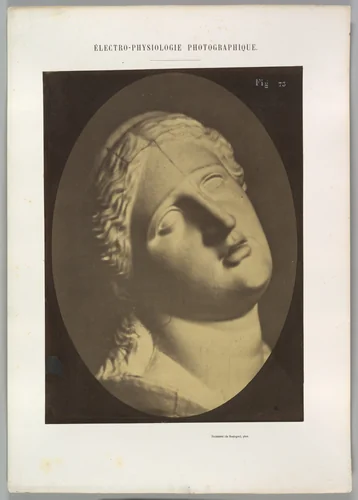 Figure 73: Head of Niobe by Guillaume Benjamin Amand Duchenne de Boulogne, photograph, 1854-1856