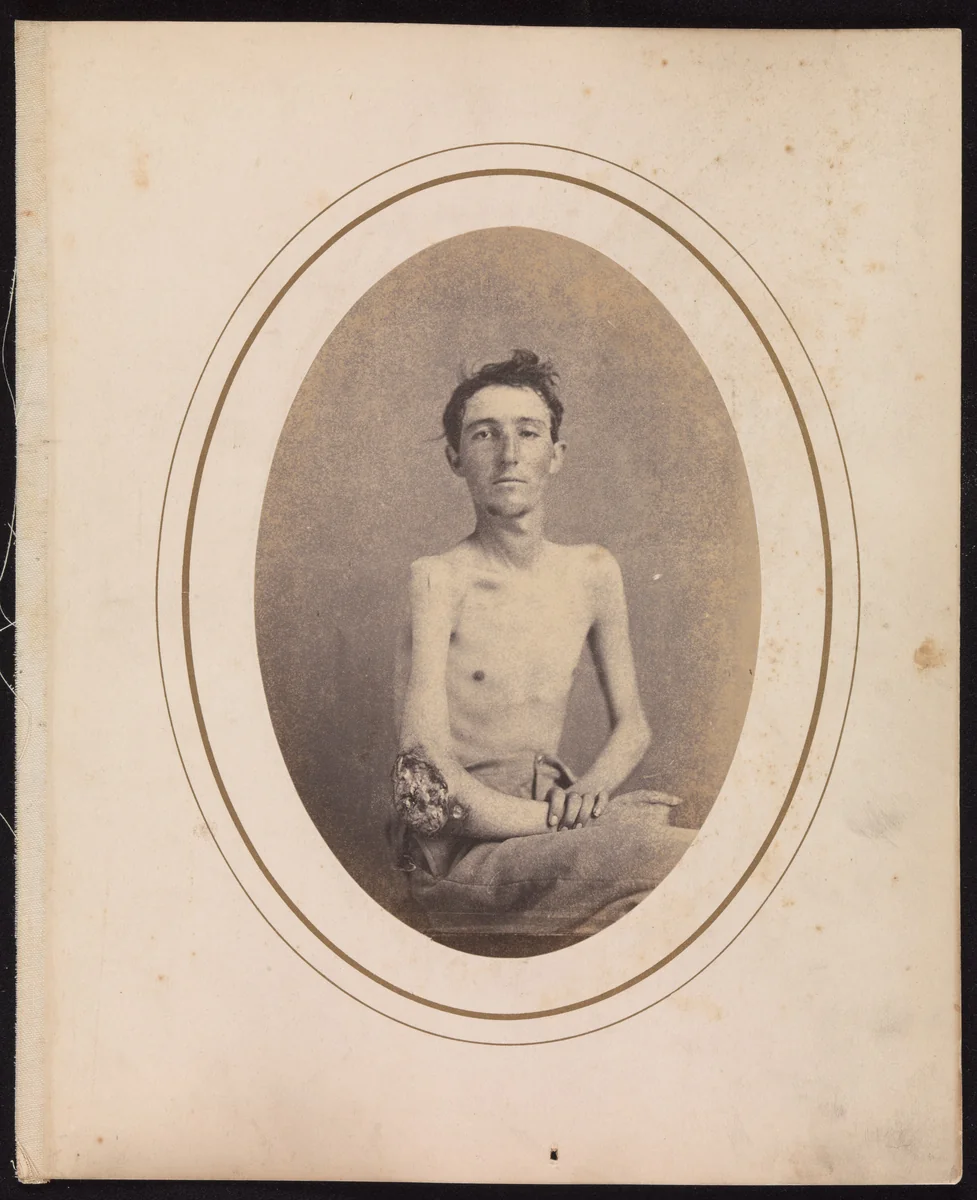 Private James H. Stokes, Company H, 185th New York Volunteers by Reed Bontecou, photograph, 1865
