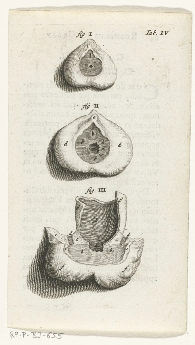 Prenten van de vrouwelijke organen by Hendrik Bary, print, 1672
