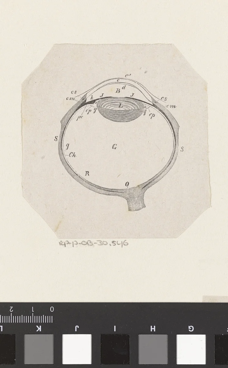 Menselijk oog met een afwijking by Isaac Weissenbruch, print, 1836-1912