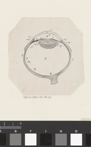Menselijk oog met een afwijking by Isaac Weissenbruch, print, 1836-1912