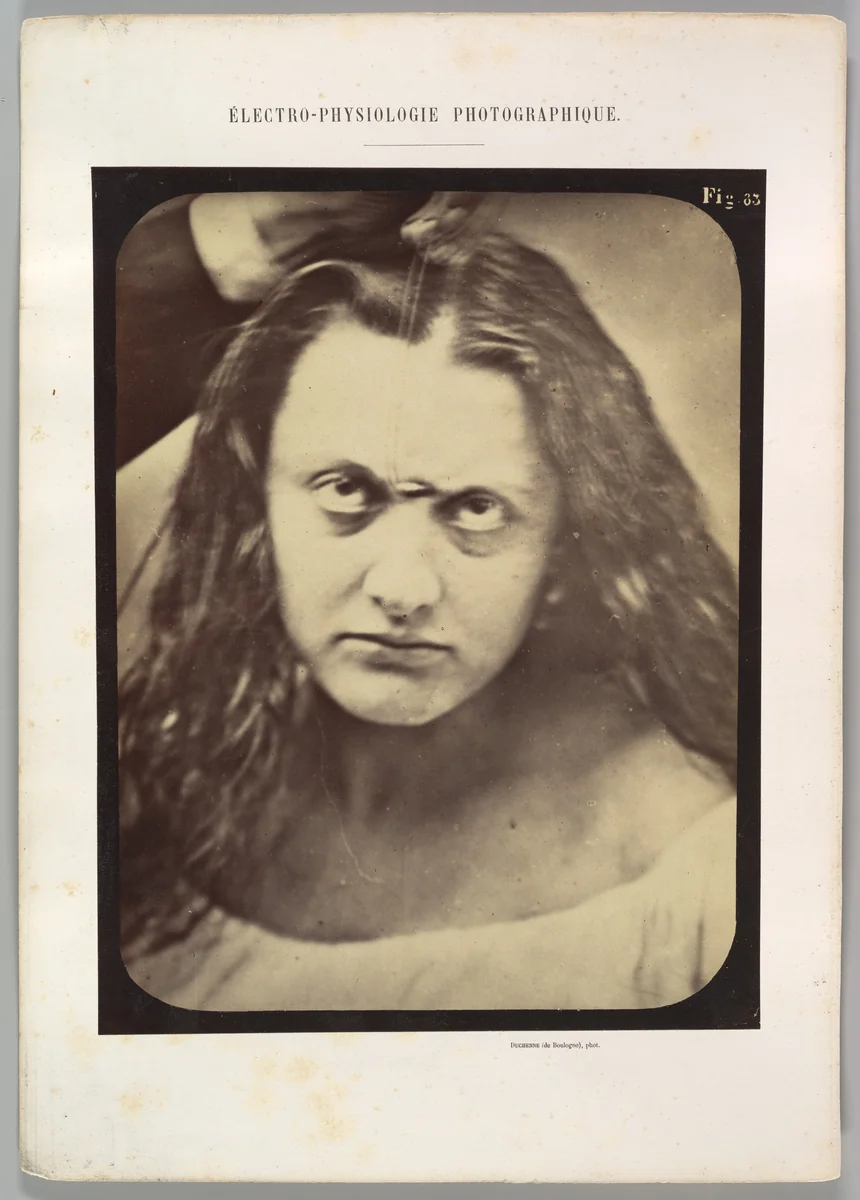 Figure 83: Lady Macbeth, ferocious cruelty by Guillaume Benjamin Amand Duchenne de Boulogne, photograph, 1854-1856