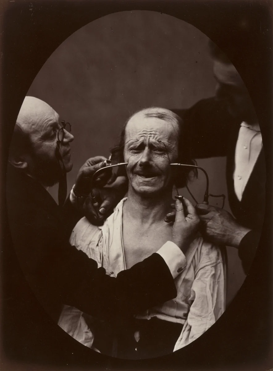 Plate 34 from the chapter The muscles of Joy and Benevolence by Guillaume Duchenne de Boulogne, Adrien Tournachon, photograph, 1856