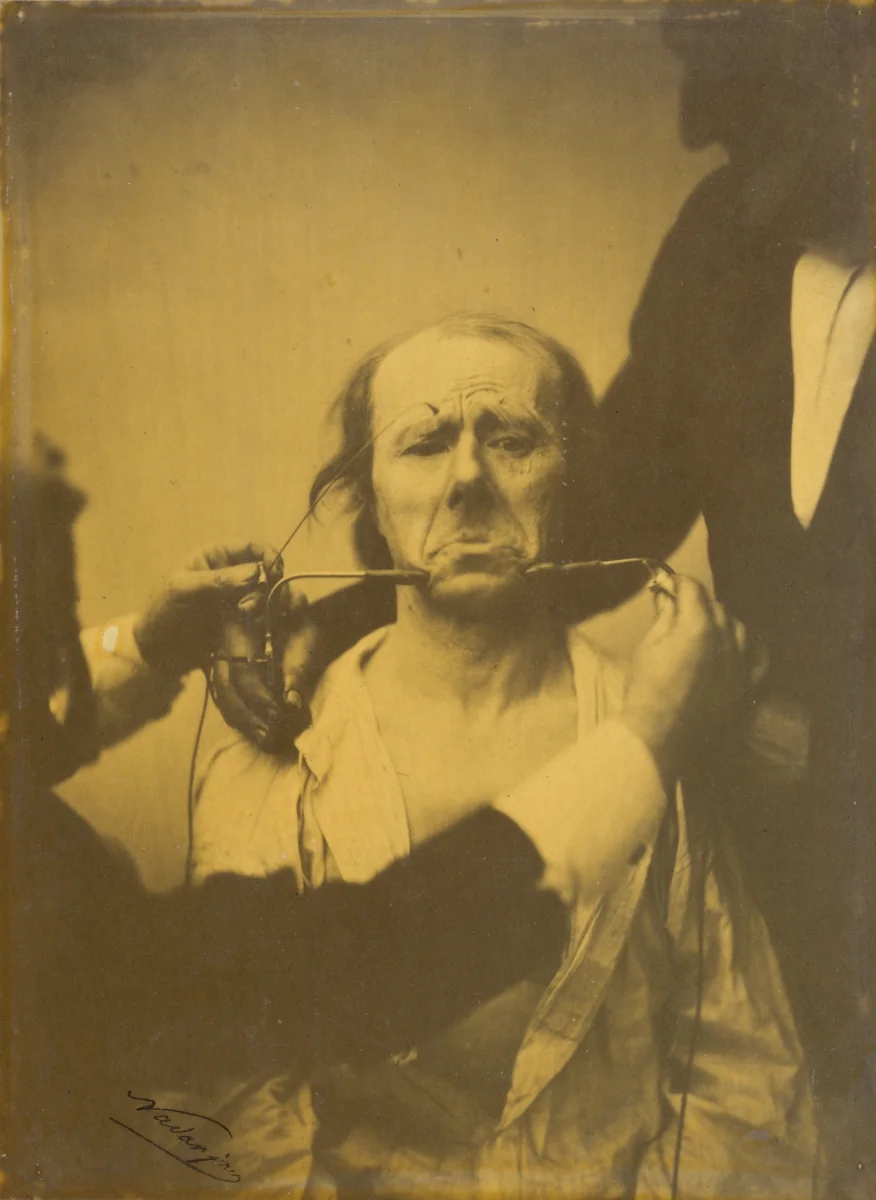 Pain and despair by Guillaume-Benjamin-Amant Duchenne; Adrien Tournachon, photograph, 1854-1856