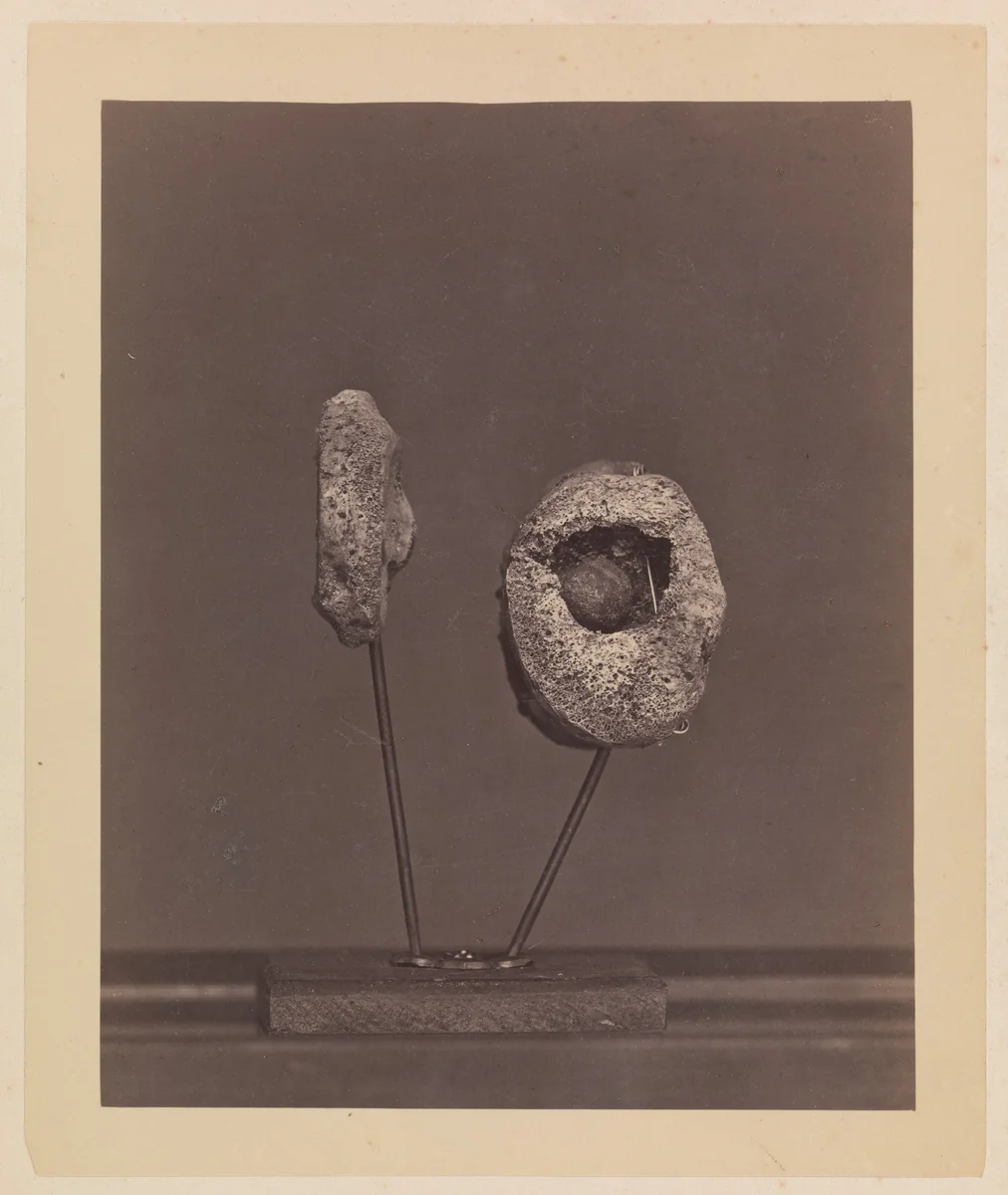 Excised Knee Joint. A Round Musket Ball in the Inner Condyle of the Right Femur [Gardiner Lewis, Company B, Nineteenth Indiana Volunteers] by William H. Bell, photograph, 1866-1867