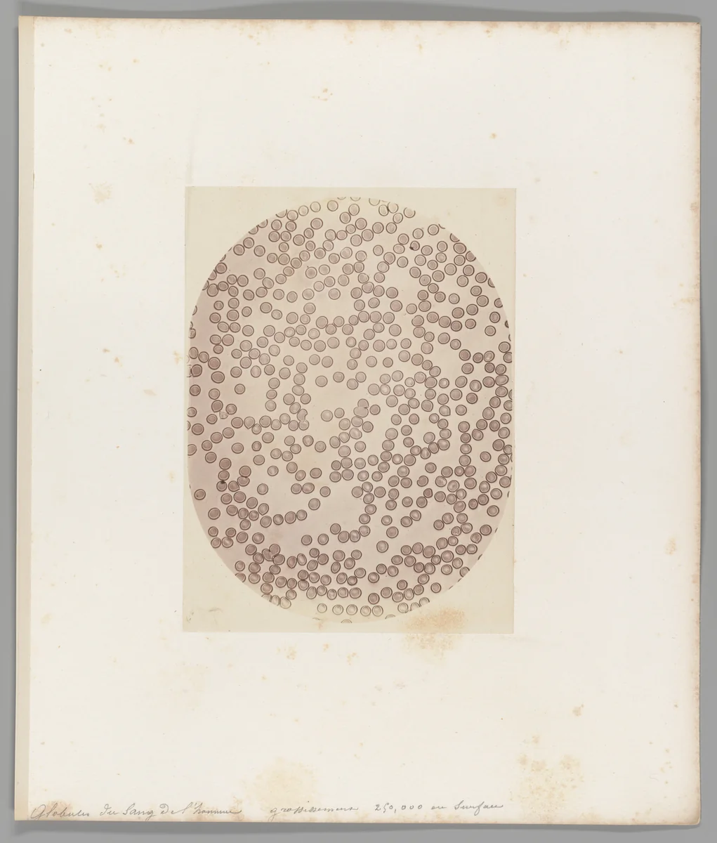 Globules du sang del’homme grossissement 250,000 en Surface [Human Blood Cells] by Auguste-Adolphe Bertsch, photograph, 1853-1857