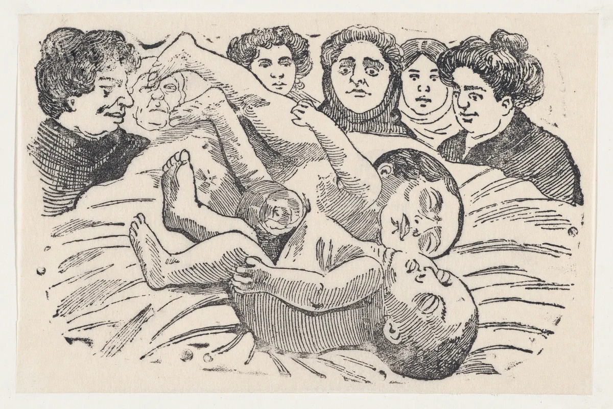 Siamese Twins by José Guadalupe Posada, print, 1875-1885
