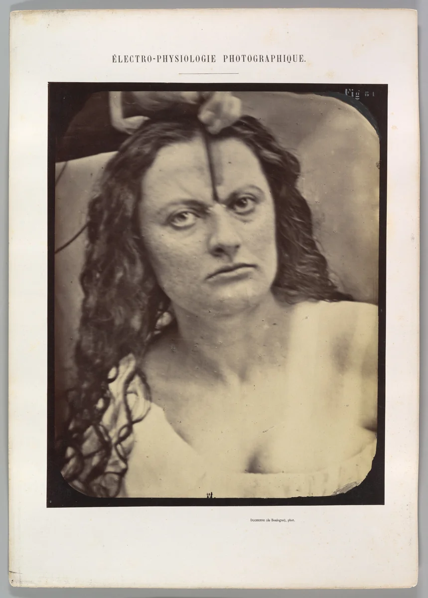 Figure 81: Lady Macbeth, moderate expression of cruelty by Guillaume Benjamin Amand Duchenne de Boulogne, photograph, 1854-1856