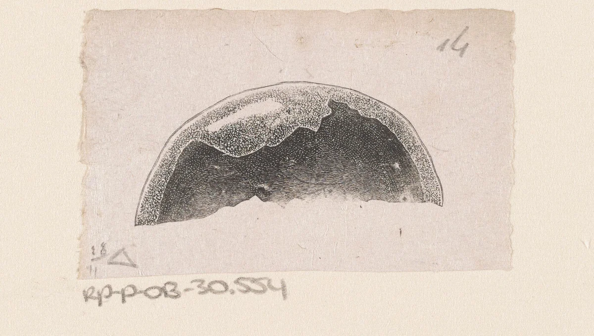 Menselijke schedel met een afwijking by Isaac Weissenbruch, print, 1836-1912