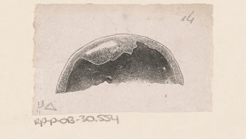 Menselijke schedel met een afwijking by Isaac Weissenbruch, print, 1836-1912