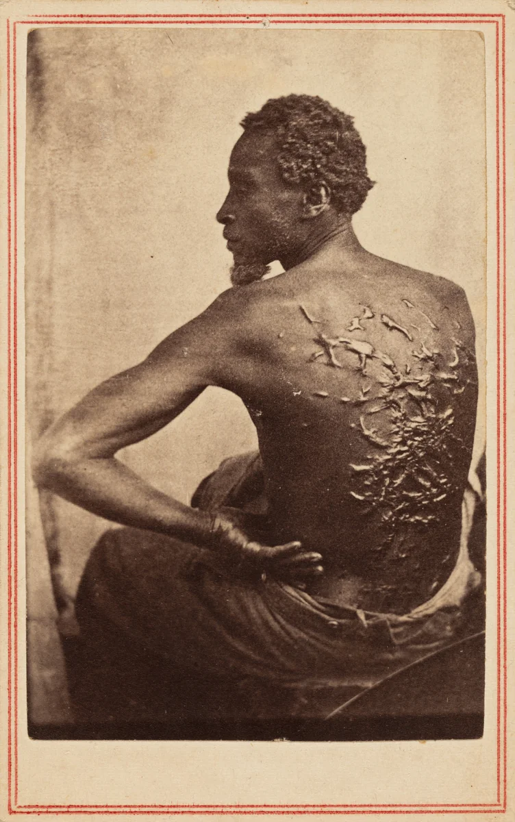 The Scourged Back by McPherson & Oliver, photograph, 1863